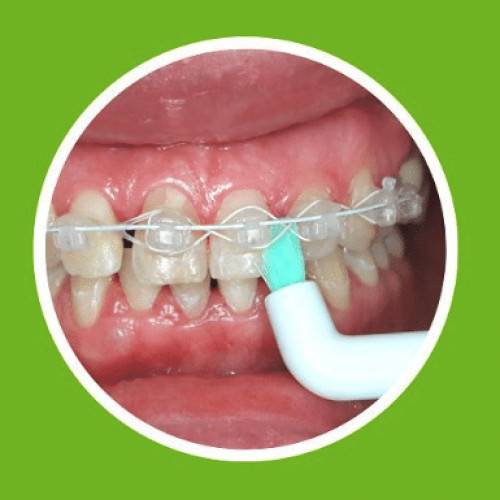 ApaCare Sonic 3D Sensitive Single Tuft Toothbrush Heads 2pcs