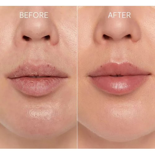 Glov Lip Regeneration Duo 1pcs