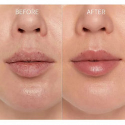 Glov Lip Regeneration Duo 1pcs