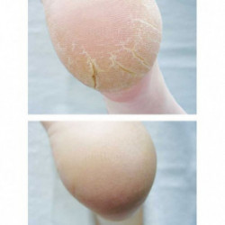 Footlogix Cracked Heel Formula Mousse 125ml